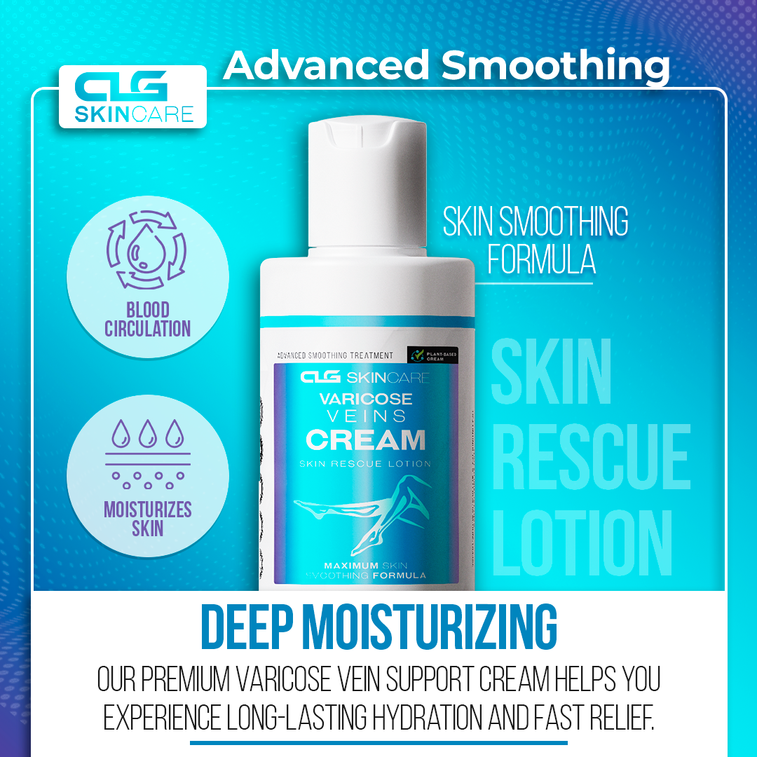 Varicose Veins Cream