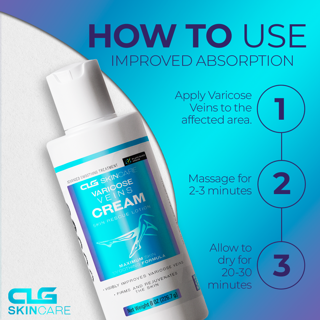 Varicose Veins Cream