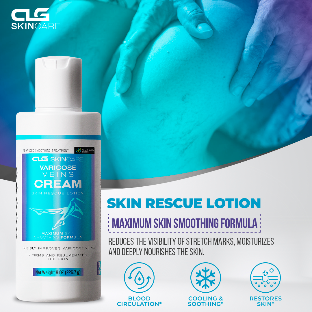 Varicose Veins Cream